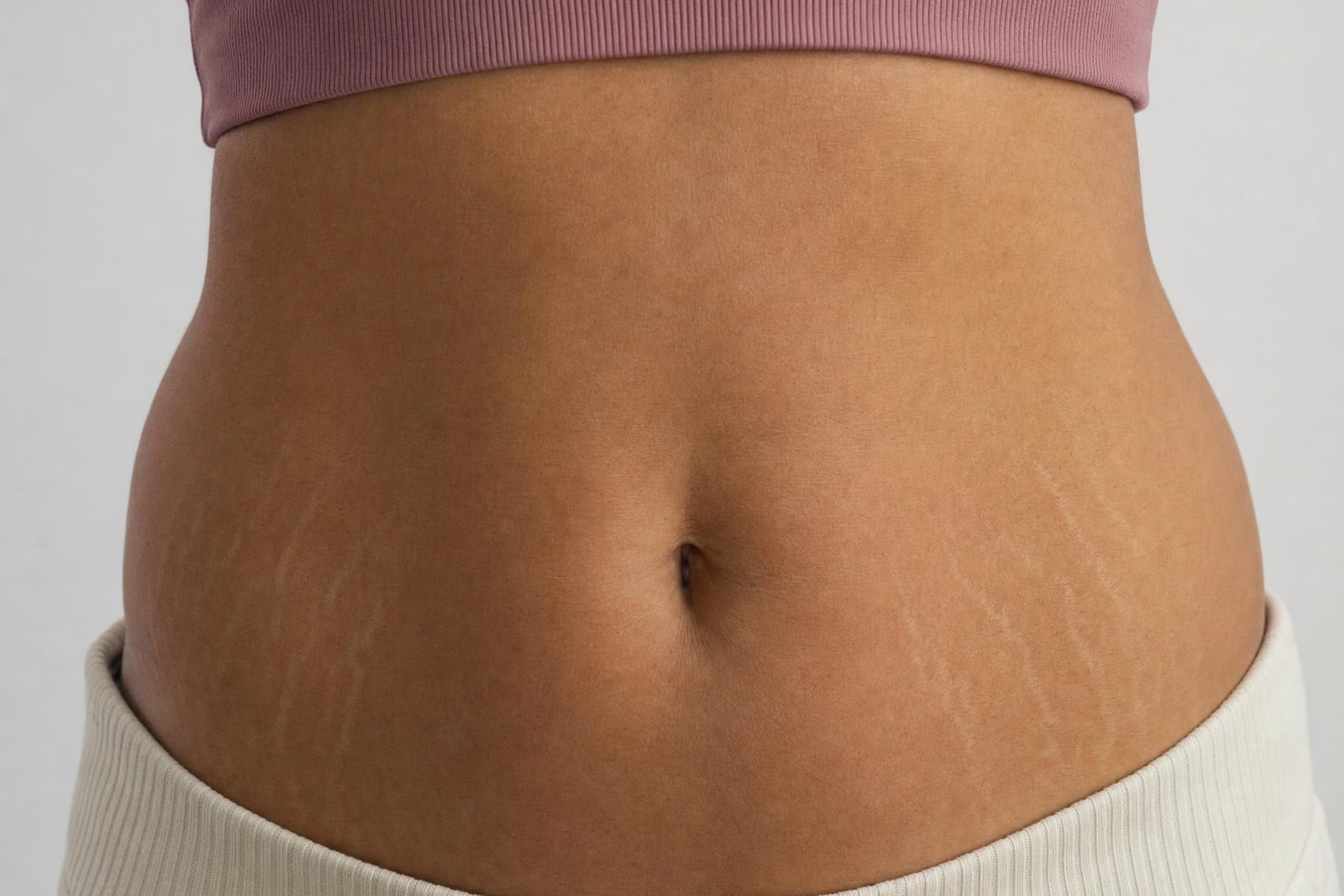 Close-up of faint stretch marks on a midriff in soft daylight