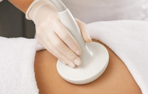 miya-body-contouring-treatment Ultrasound body-contouring applicator on a draped abdomen
